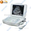 Full Digital Ultrasound Medical Machine